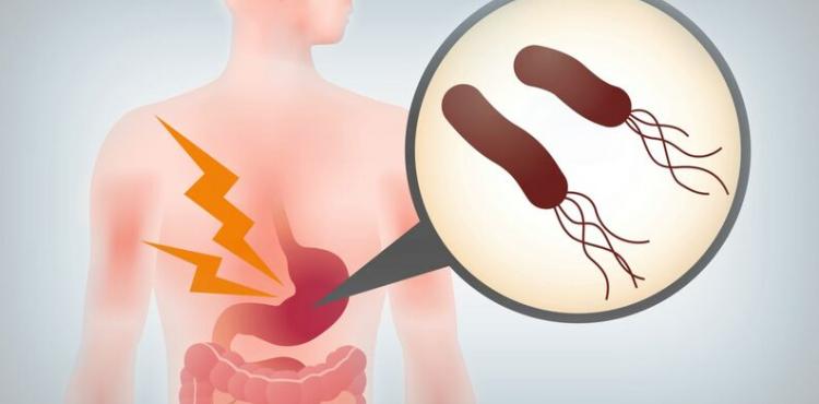 Infecao Por Helicobacter Pylori Jornal Nordeste