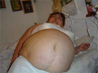 Obesidade tirou-lhe a alegria de viver