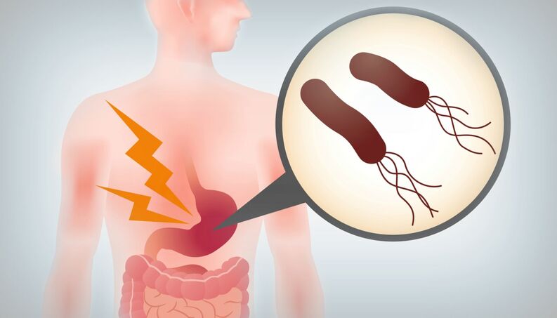 Infeção por Helicobacter pylori